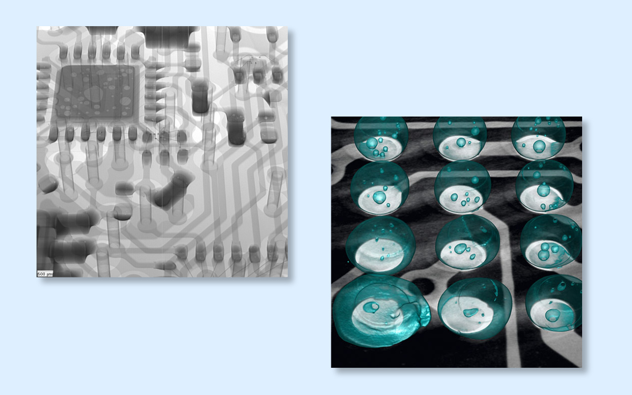 4. 2D vs 3D CT X-ray Which One Do You Really Need? 4. 2D vs 3D CT X-ray Which One Do You Really Need?