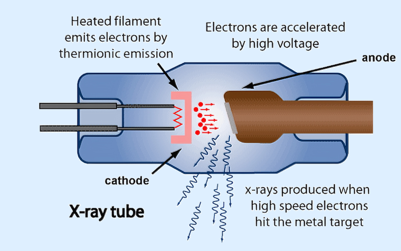 2. What X-ray Technology Actually Does 2. What X-ray Technology Actually Does